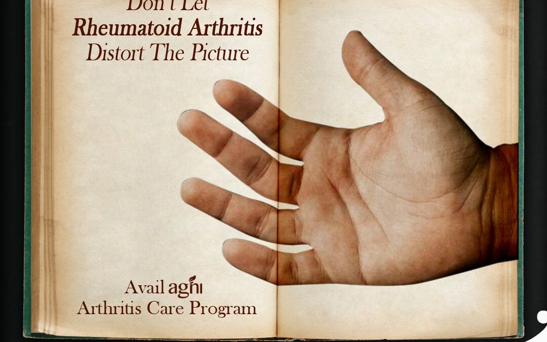 Ayurvedic Treatments for Rheumatoid Arthritis