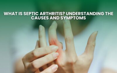 What is Septic Arthritis? Understanding the Causes and Symptoms