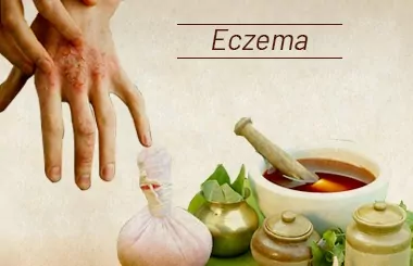 Eczema