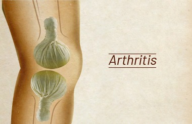 Ayurvedic Remedies for Osteoarthritis