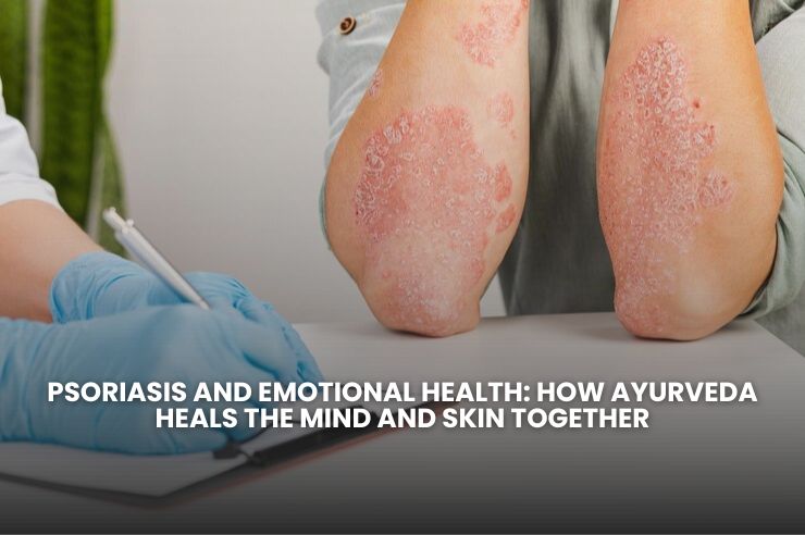 Ayurveda for psoriasis and emotional balance