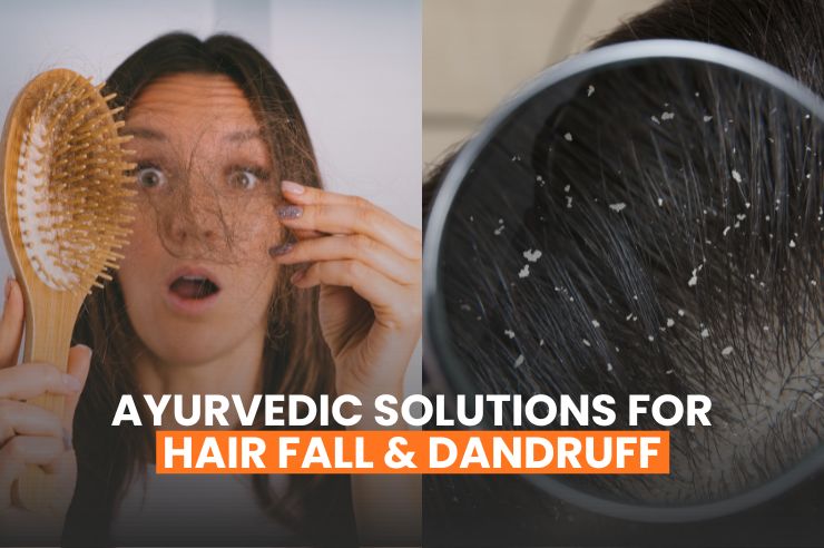 Ayurvedic solution for dandruff and hair fall